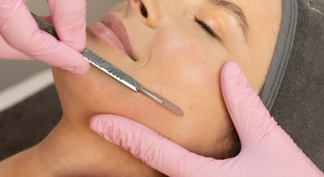 Dermaplaning