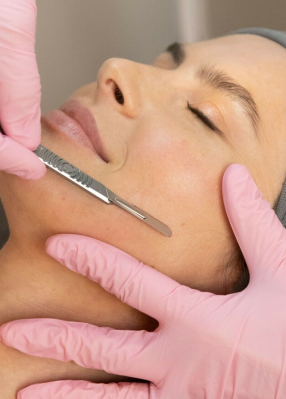 Dermaplaning